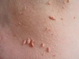 Kosmetolog Nowy Dwór Mazowiecki